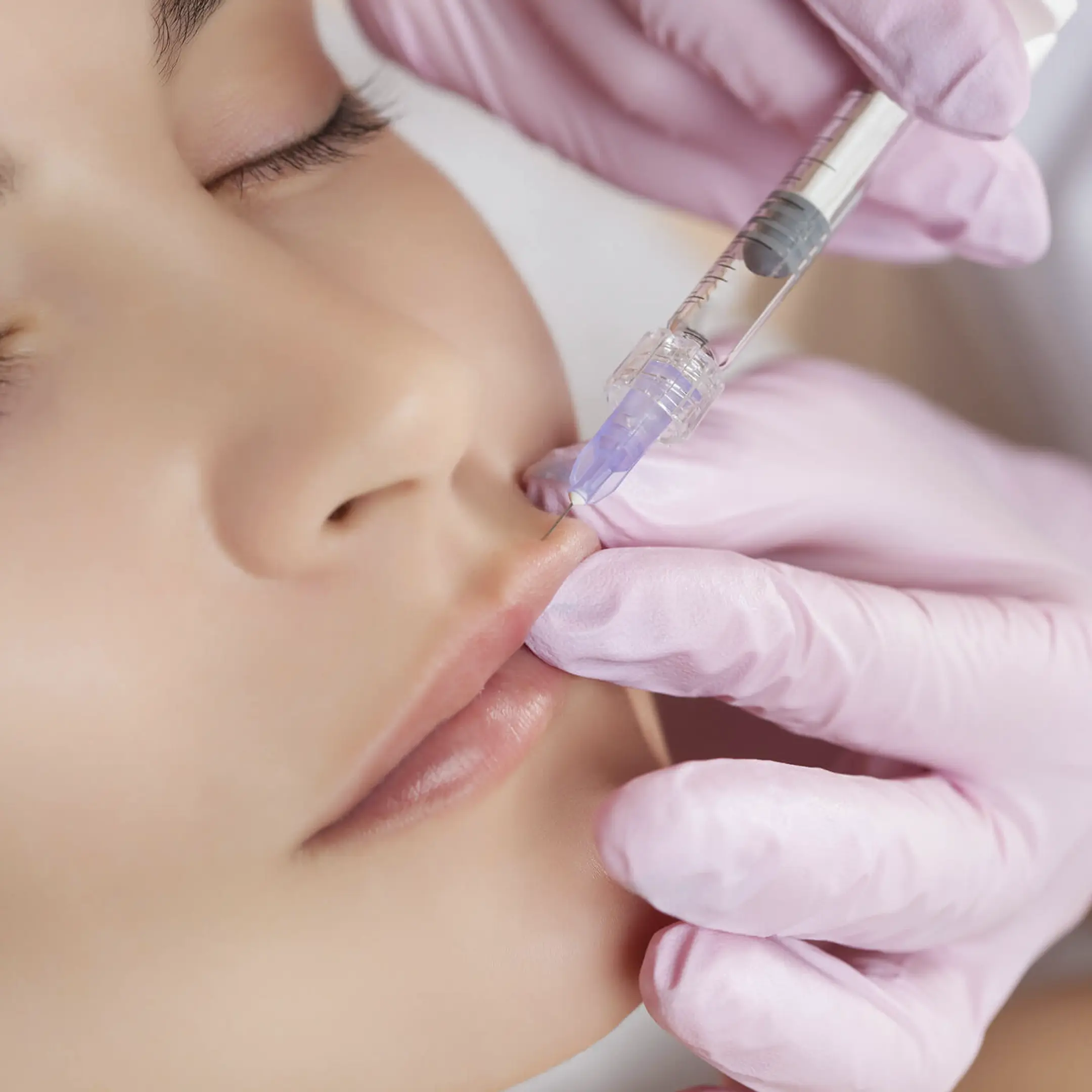 Preenchimento Labial